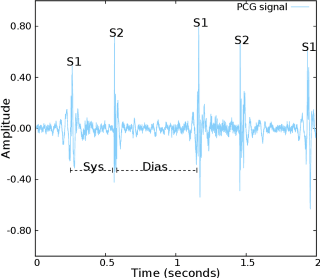 Figure 2 for The CirCor DigiScope Dataset: From Murmur Detection to Murmur Classification