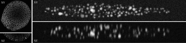 Figure 2 for Spherical Harmonics for Shape-Constrained 3D Cell Segmentation
