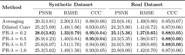 Figure 2 for DeepASL: Kinetic Model Incorporated Loss for Denoising Arterial Spin Labeled MRI via Deep Residual Learning