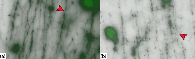 Figure 1 for NeuRegenerate: A Framework for Visualizing Neurodegeneration