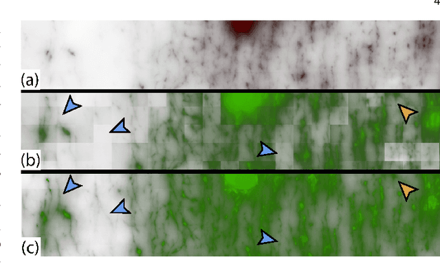 Figure 4 for NeuRegenerate: A Framework for Visualizing Neurodegeneration