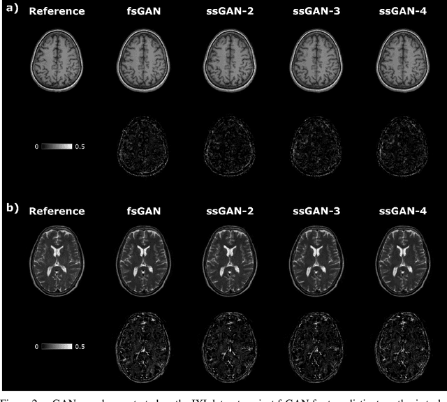 Figure 3 for Semi-Supervised Learning of Mutually Accelerated Multi-Contrast MRI Synthesis without Fully-Sampled Ground-Truths