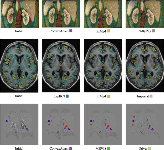 Figure 2 for Learn2Reg: comprehensive multi-task medical image registration challenge, dataset and evaluation in the era of deep learning