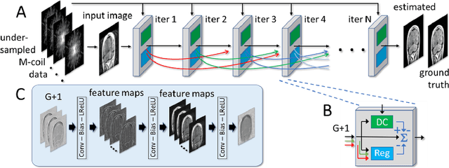 Figure 3 for Conditional WGANs with Adaptive Gradient Balancing for Sparse MRI Reconstruction