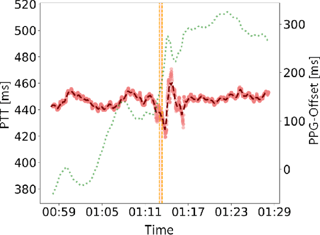 Figure 3 for Automatic Seizure Detection Using the Pulse Transit Time