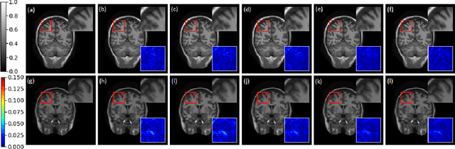 Figure 4 for Co-VeGAN: Complex-Valued Generative Adversarial Network for Compressive Sensing MR Image Reconstruction