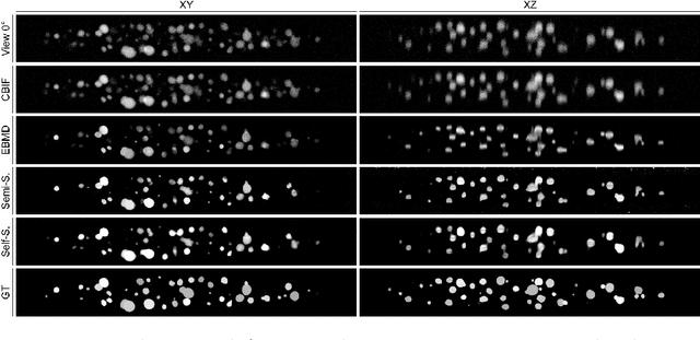 Figure 4 for Semi- and Self-Supervised Multi-View Fusion of 3D Microscopy Images using Generative Adversarial Networks