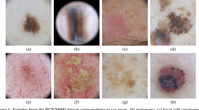 Figure 1 for BCN20000: Dermoscopic Lesions in the Wild
