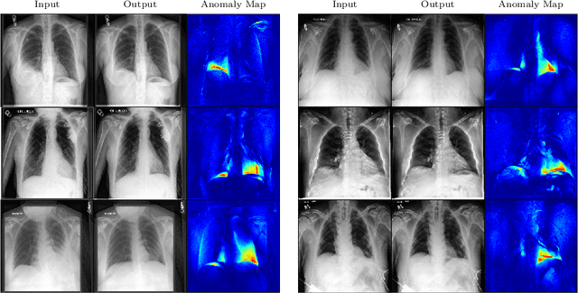 Figure 2 for Diffusion Models for Medical Anomaly Detection