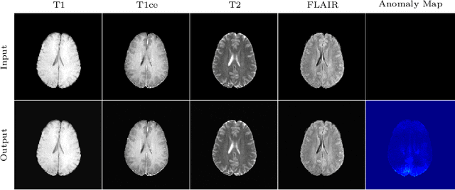 Figure 4 for Diffusion Models for Medical Anomaly Detection