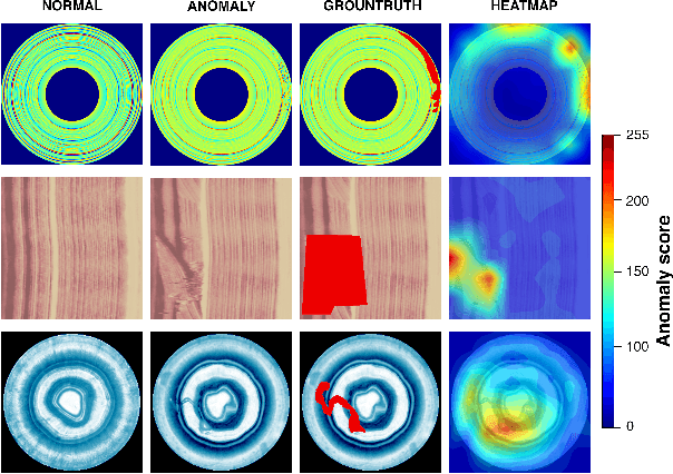 Figure 1 for VT-ADL: A Vision Transformer Network for Image Anomaly Detection and Localization
