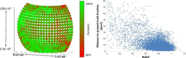 Figure 4 for X-ray-transform Invariant Anatomical Landmark Detection for Pelvic Trauma Surgery