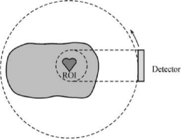 Figure 1 for A practical local tomography reconstruction algorithm based on known subregion