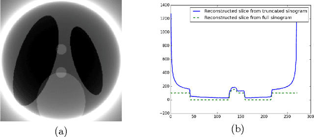 Figure 4 for A practical local tomography reconstruction algorithm based on known subregion