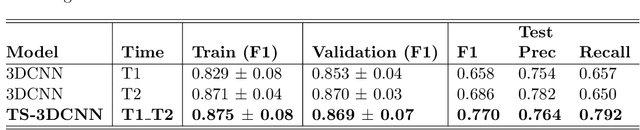 Figure 2 for Pulmonary Nodule Malignancy Classification Using its Temporal Evolution with Two-Stream 3D Convolutional Neural Networks