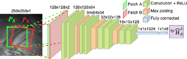 Figure 1 for Deep Sequential Mosaicking of Fetoscopic Videos