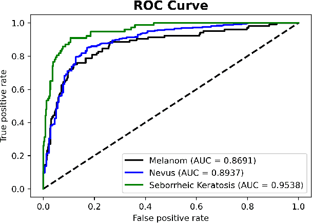 Figure 1 for Benchmarking of Lightweight Deep Learning Architectures for Skin Cancer Classification using ISIC 2017 Dataset