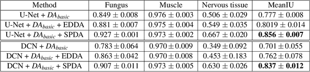 Figure 4 for SPDA: Superpixel-based Data Augmentation for Biomedical Image Segmentation