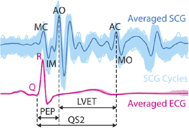 Figure 1 for End-to-End Deep Learning for Reliable Cardiac Activity Monitoring using Seismocardiograms