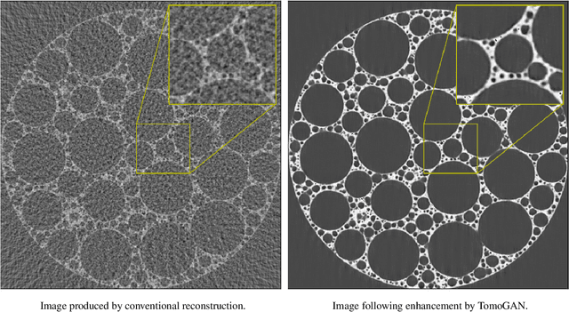Figure 1 for TomoGAN: Low-Dose X-Ray Tomography with Generative Adversarial Networks