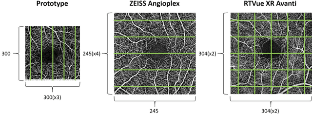 Figure 1 for Deep learning vessel segmentation and quantification of the foveal avascular zone using commercial and prototype OCT-A platforms