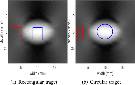 Figure 4 for Incorporating Gradient Similarity for Robust Time Delay Estimation in Ultrasound Elastography