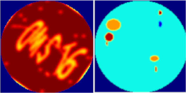 Figure 1 for Sinogram Denoise Based on Generative Adversarial Networks