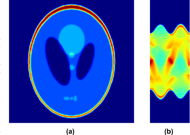 Figure 3 for Sinogram Denoise Based on Generative Adversarial Networks