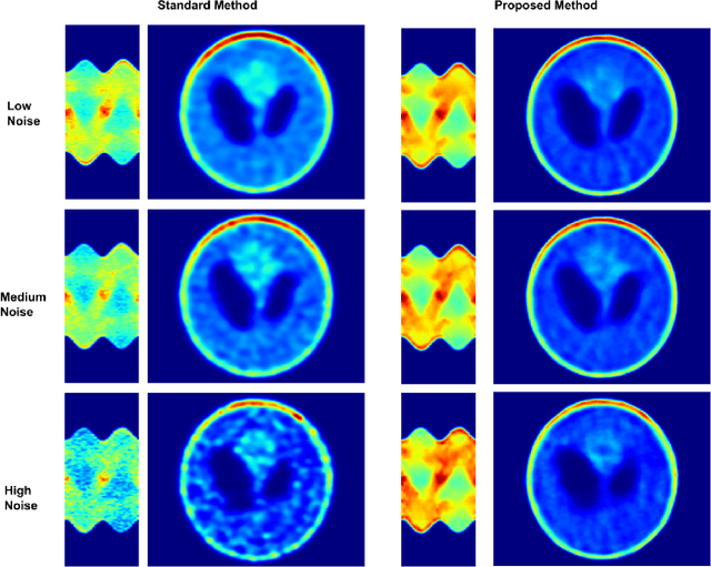 Figure 4 for Sinogram Denoise Based on Generative Adversarial Networks