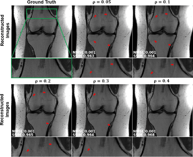 Figure 4 for Self-Supervised Learning of Physics-Based Reconstruction Neural Networks without Fully-Sampled Reference Data