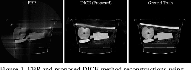 Figure 1 for Integrating Data and Image Domain Deep Learning for Limited Angle Tomography using Consensus Equilibrium