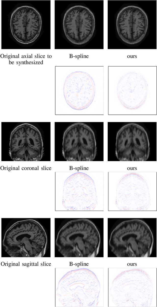 Figure 4 for Autoencoding Low-Resolution MRI for Semantically Smooth Interpolation of Anisotropic MRI