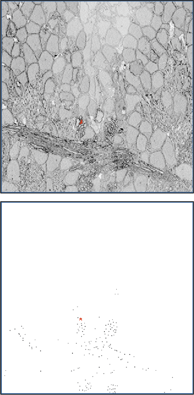 Figure 1 for Understanding Neural Pathways in Zebrafish through Deep Learning and High Resolution Electron Microscope Data
