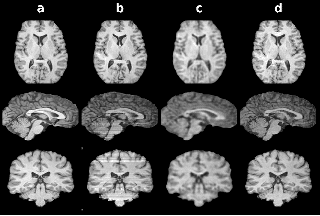 Figure 1 for Three Dimensional MR Image Synthesis with Progressive Generative Adversarial Networks