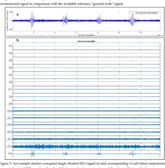 Figure 4 for Motion Artifacts Correction from Single-Channel EEG and fNIRS Signals using Novel Wavelet Packet Decomposition in Combination with Canonical Correlation Analysis