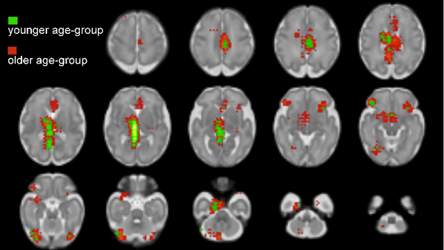 Figure 4 for Interpreting Age Effects of Human Fetal Brain from Spontaneous fMRI using Deep 3D Convolutional Neural Networks