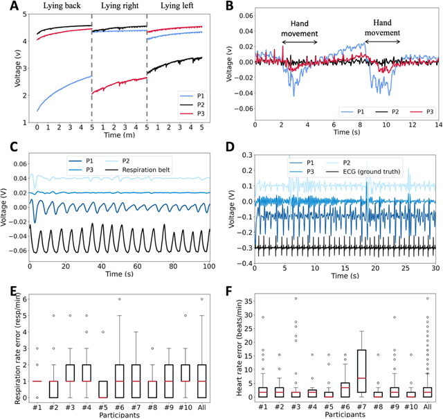 Figure 3 for PhyMask: Robust Sensing of Brain Activity and Physiological Signals During Sleep with an All-textile Eye Mask