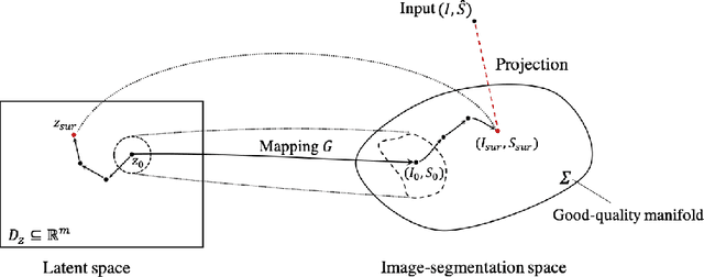 Figure 1 for Deep Generative Model-based Quality Control for Cardiac MRI Segmentation