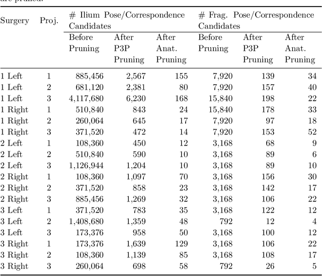 Figure 4 for Fast and Automatic Periacetabular Osteotomy Fragment Pose Estimation Using Intraoperatively Implanted Fiducials and Single-View Fluoroscopy