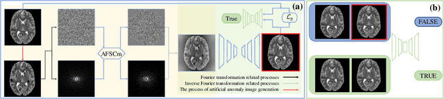 Figure 1 for AFSC: Adaptive Fourier Space Compression for Anomaly Detection