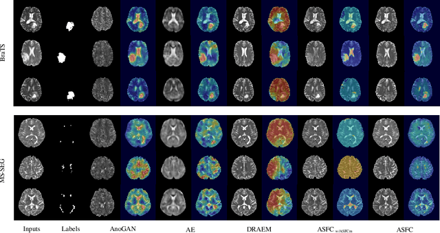 Figure 4 for AFSC: Adaptive Fourier Space Compression for Anomaly Detection