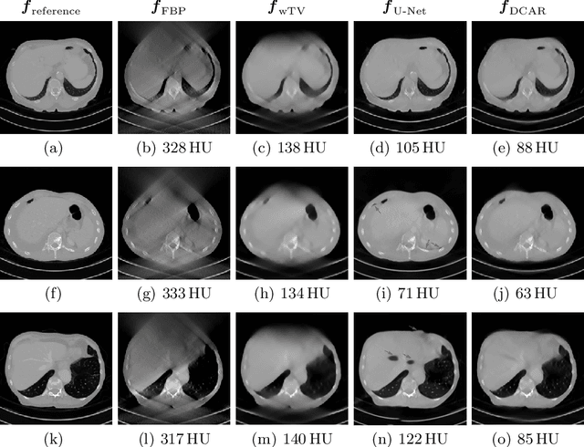Figure 3 for Data Consistent Artifact Reduction for Limited Angle Tomography with Deep Learning Prior
