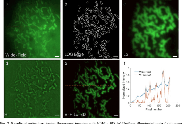 Figure 1 for Single-shot wide-field optical section imaging