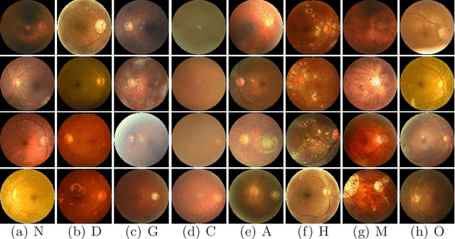 Figure 3 for A Benchmark of Ocular Disease Intelligent Recognition: One Shot for Multi-disease Detection