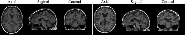 Figure 1 for Morphology-preserving Autoregressive 3D Generative Modelling of the Brain