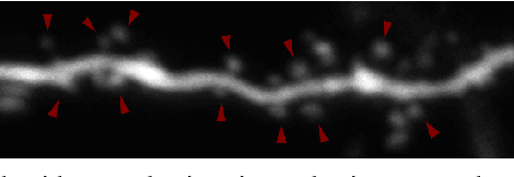 Figure 1 for Dendritic Spine Shape Analysis: A Clustering Perspective