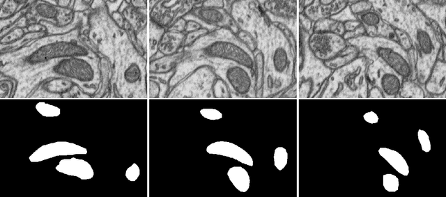 Figure 1 for A small note on variation in segmentation annotations