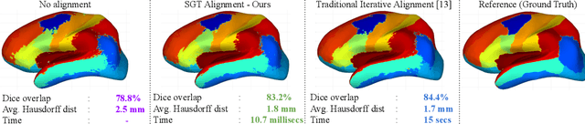 Figure 4 for Spectral Graph Transformer Networks for Brain Surface Parcellation