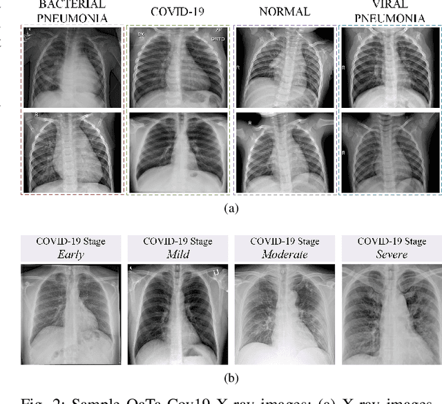 Figure 2 for Convolutional Sparse Support Estimator Based Covid-19 Recognition from X-ray Images