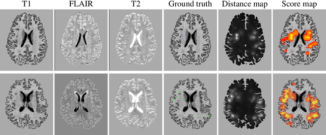 Figure 4 for 3D multirater RCNN for multimodal multiclass detection and characterisation of extremely small objects